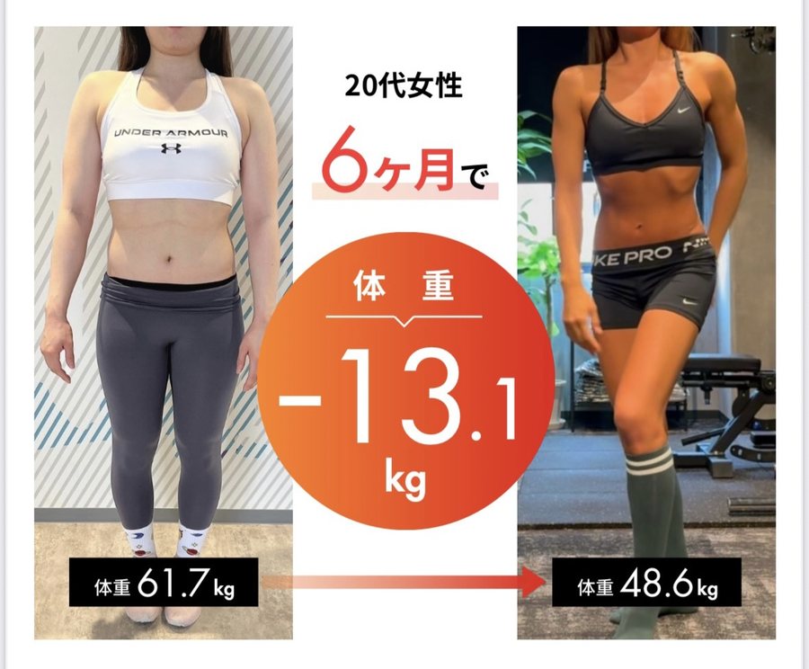 20代女性／6ヶ月 ビフォーアフター