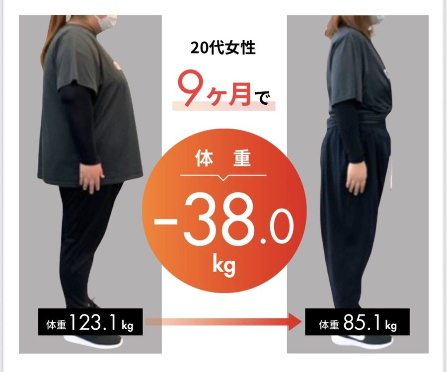 20代女性／9ヶ月 ビフォーアフター